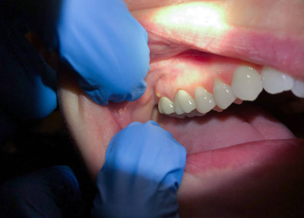 Best Weekend Emergency Dental Services in South Connellsville, PA