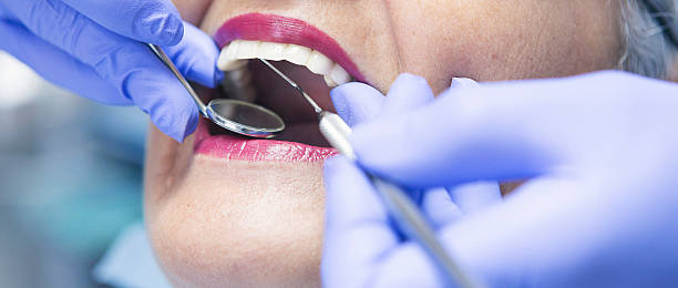 Best Knocked-Out Tooth (Avulsed Tooth) Treatment in South Connellsville, PA